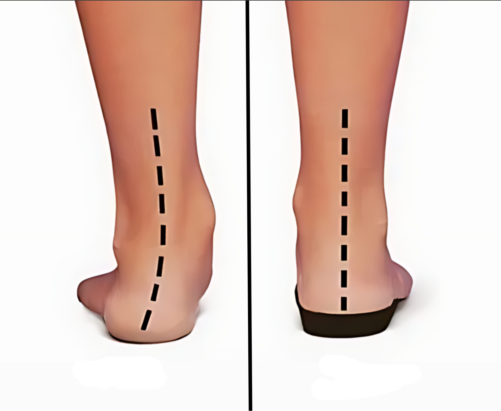 Damen Sneaker mit orthopädischer Unterstützung für optimalen Komfort 2