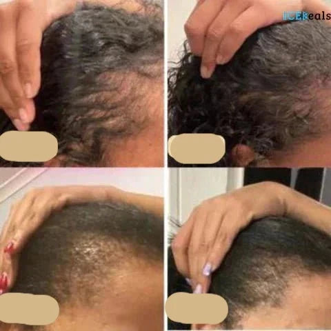 Haarwuchsöl für Frauen und Männer - Natürliche Pflege für Alle Haartypen 1