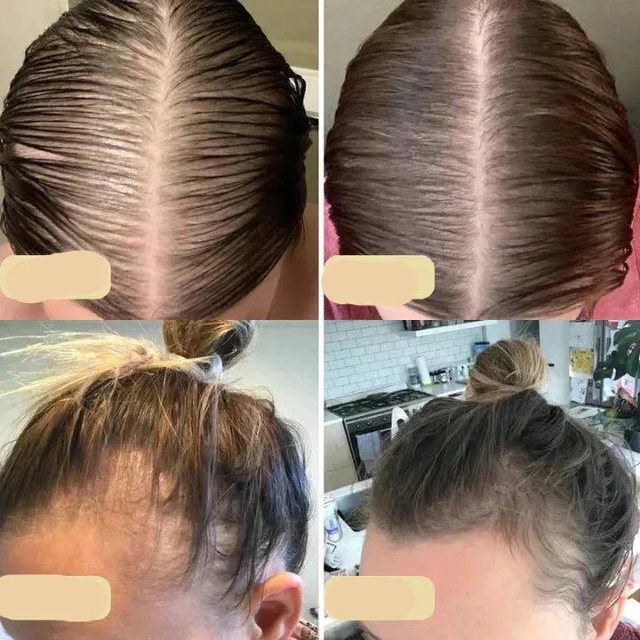 Haarwuchsöl für Frauen und Männer - Natürliche Pflege für Alle Haartypen 3
